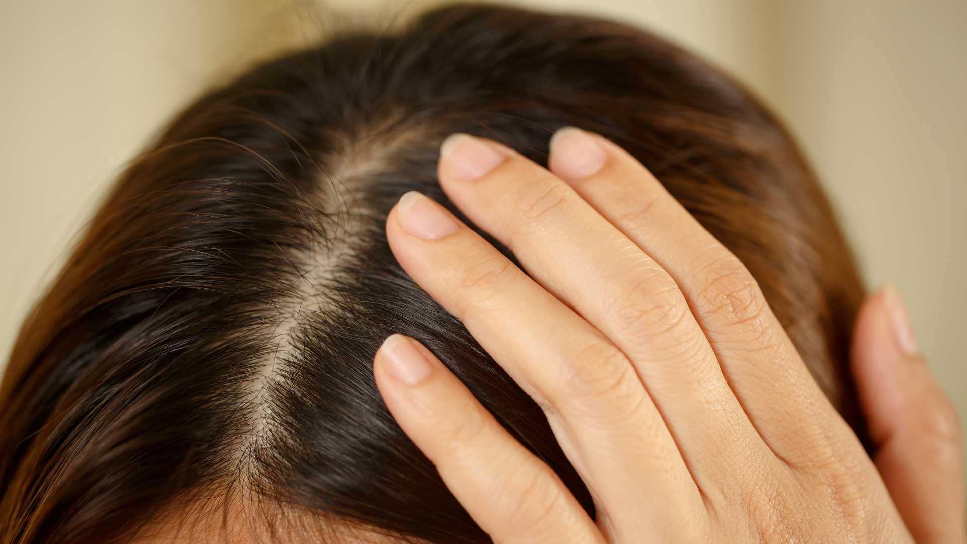 Secrets to Scalp Health