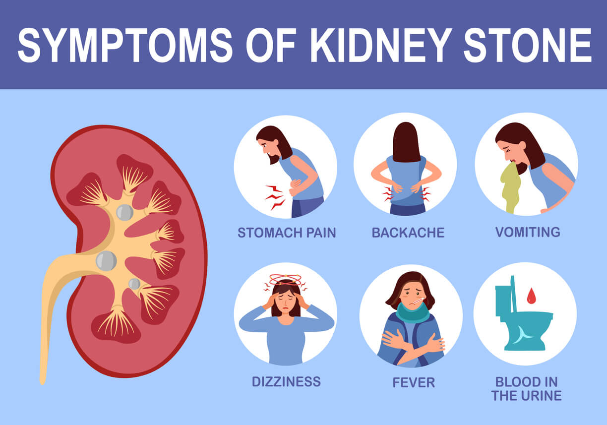 What causes kidney stones?